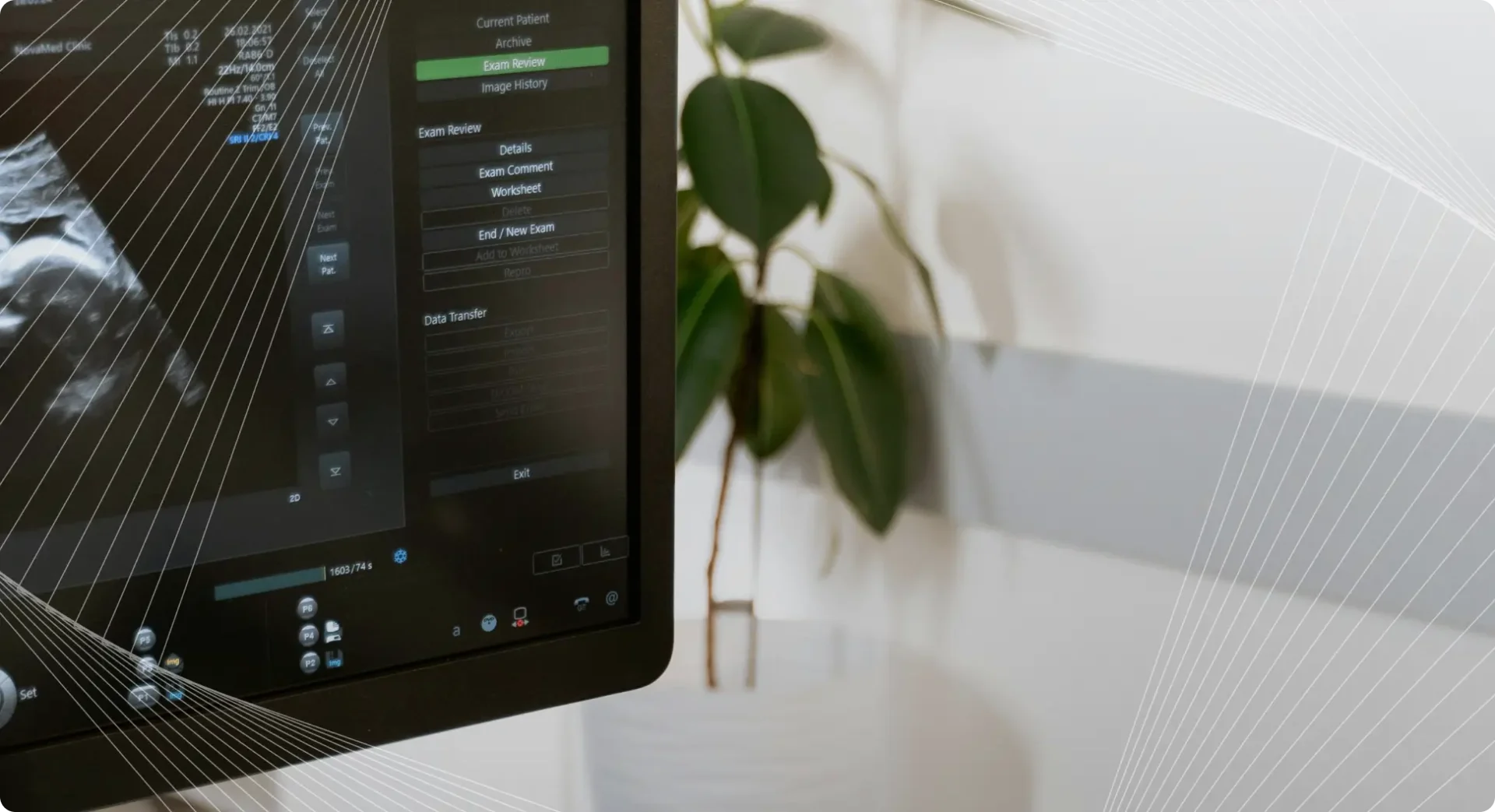 Close-up of a computer screen displaying an ultrasound interface